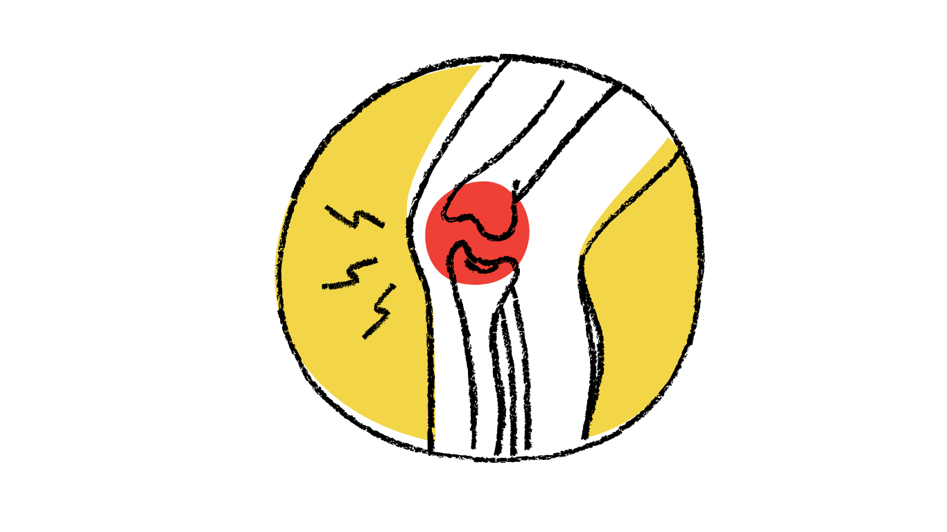 麻布で膝の痛みにお悩みの方へ｜整体×ピラティスで根本から改善する方法
