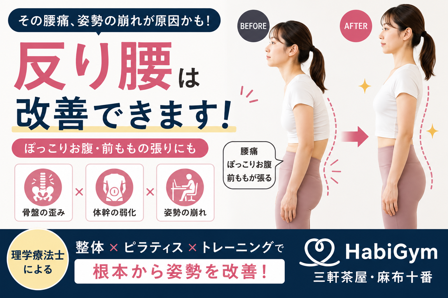 反り腰は改善できる？｜理学療法士が原因と正しい改善方法を解説